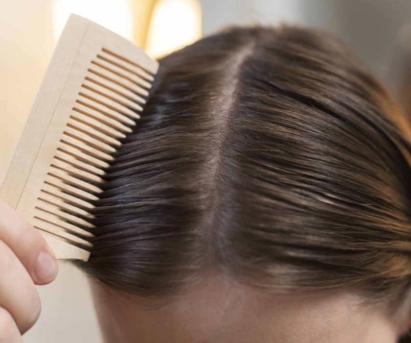 Protesi Capillari per Donne