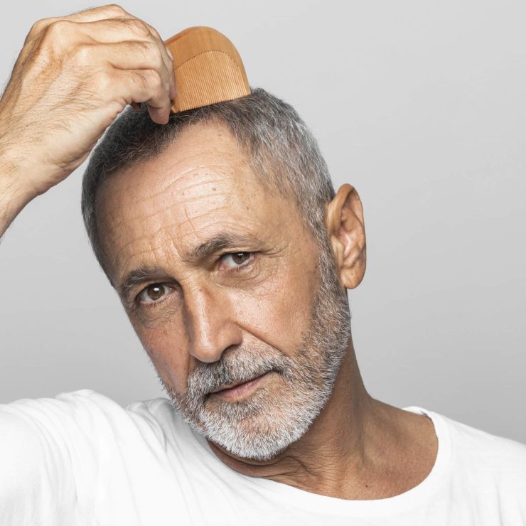 Hair Loss