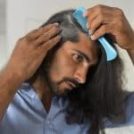 Always Perfect Hair - Des implants capillaires sur mesure pour vous
